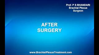 Erbs Palsy Right Surgery [upl. by Turro]