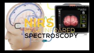 Nearinfrared Spectroscopy using INVOS [upl. by Marco46]