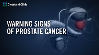 10 Warning Signs of Prostate Cancer [upl. by Garbe663]