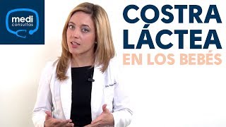 ¿Qué es la costra láctea en los bebés MediConsultas [upl. by Amara]