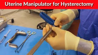 Uterine Manipulator for Hysterectomy  Dr Kunal Rathod [upl. by Enilorac]