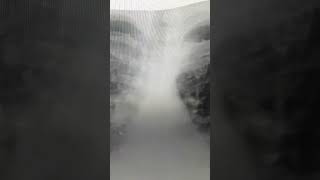 PNEUMONIACOUGH FEVER DIFFICULTY BREATHING CHEST PAIN NEED CONSULTATION CHEST PHYSICIAN [upl. by Wolfy]