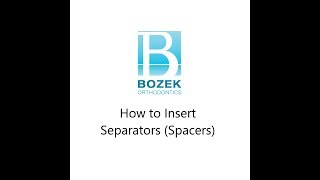 How to Insert Orthodontic Separators Spacers [upl. by Atteuqehs]