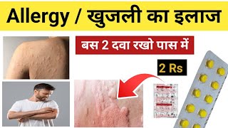 Itching Problem Treatment in Hindi  Khujli Ki Dawa  cetrizine amp betnesal  खुजली खत्म कैसे करे [upl. by Manny]