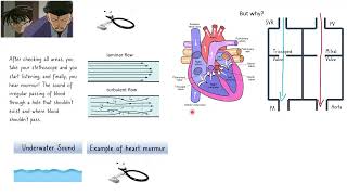 Congenital Heart Diseases Main ideas 1 [upl. by Okiruy]