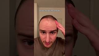 Do you not get the concept hair hairtransformation hairgrowth [upl. by Hras775]