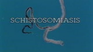 Schistosomiasis Pt 1 of 3 1990 [upl. by Press582]