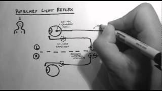 Reflexes 2  Pupillary Light Reflex [upl. by Ahsercel]