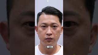 臉上痣和斑太多怎麼辦？透過除斑除痣雷射能改善 台北教主醫美整形 [upl. by Anileda56]