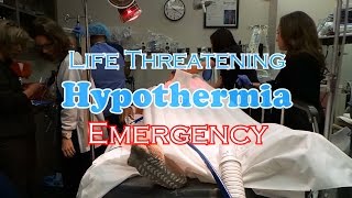 Life Threatening Hypothermia Emergency [upl. by Odelia]