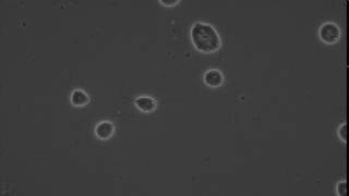 ZEISS Axio LabA1 Phase contrast live microscopy of trichomonads [upl. by Etterraj]