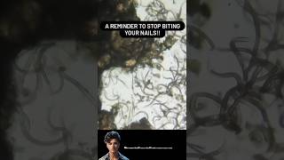 Nails Germs Under Microscope  Nails Germs 😱 shorts ytshorts microscopeview [upl. by Milka]