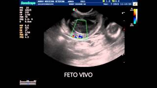 FETOS VIVOS Y FETO MUERTO DIFERENCIAS ECOGRAFICAS [upl. by Hanej312]