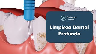 Restablece tu Salud Oral con una Limpieza Dental Profunda  The Dental District [upl. by Nor431]