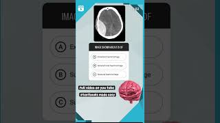 haemorrhage inicet neetmds facts dentalpractice [upl. by Nelad]