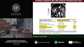 Melanie Boly  Neural Correlates of Consciousness [upl. by Ahsinor]