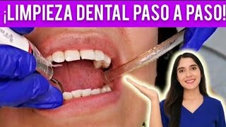 ¿CÓMO SE HACE UNA LIMPIEZA DENTAL DE CONSULTORIO  TE MUESTRO CADA PASO 🦷✅ [upl. by Sherer]