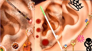 Ear Piercing Cleaning ASMR  Ear Cleaning ASMR Animation  Ear Infection Treatment ASMRidhu [upl. by Nuhs]