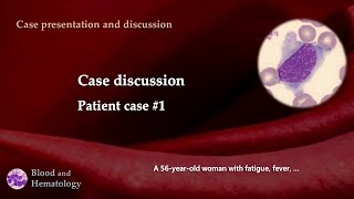 Patient case discussion case 1 [upl. by Airalednac]