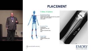 Intraosseous Access  David Carpenter MPAS PAC [upl. by Itsim]