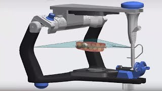 3Shape TRIOS Design Studio  Dynamic Virtual Articulator [upl. by Chemush]