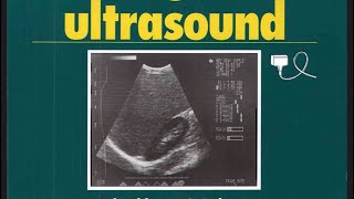 Ultrasound 2 Normal liver stage four [upl. by Amapuna389]