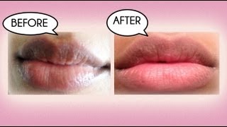 How to Lighten Dark Lips Naturally [upl. by Ellened]