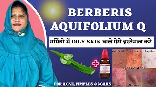 Berberis Aquifolium Q  Best Way to use for OILY SKIN in summers  Get glowing skin Instantly [upl. by Yensehc976]