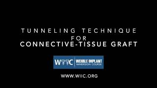 Tunneling Technique for ConnectiveTissue Graft [upl. by Iiette]