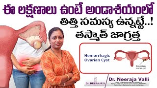 Causes amp Treatment for Hemorrhagic Cyst  Dr Neerajas Fertility amp Gynaec Center [upl. by Neehsar640]