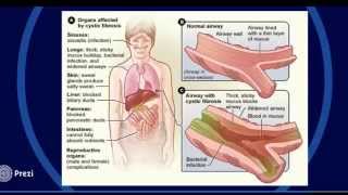 PROTEÍNA CFTR FIBROSIS QUÍSTICA [upl. by Dodds241]