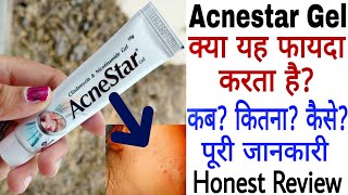 Acnestar Gel Review  Acnestar Gel Kaise Use Kare  Acnestar Gel Ke Fayde [upl. by Weinhardt661]