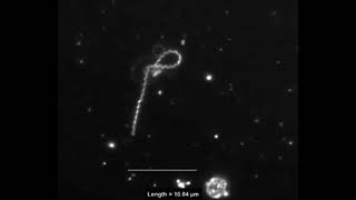 Interaction of Treponema pallidum the syphilis spirochete with human platelets [upl. by Aicilaanna]