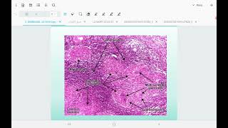 Pathology  infections lec1 part 2 [upl. by Anit]