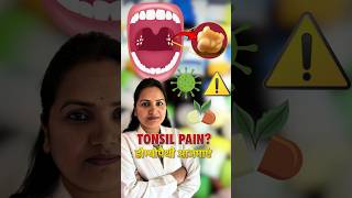 Tonsil stones Treatment  Tonsillitis medicine in homeopathy [upl. by Carpio135]