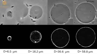 Motion of Bacterium confined within a Giant Unilamellar VesicleGUV [upl. by Lauralee]