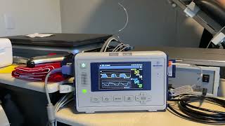 EndTidal CO2 capnography in a tilt test [upl. by Joselow]