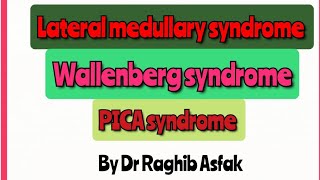 Lateral medullary syndrome Wallenberg syndrome PICA syndrome by Dr Raghib Asfak [upl. by Aenet]