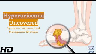 Hyperuricemia Understanding Its Signs Effects amp Management Essentials [upl. by Ellynn926]