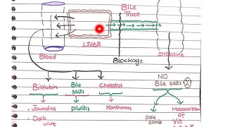 Cholestasis  Pathology [upl. by Rowley594]