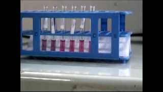 DCN Diagnostics Lateral Flow Assay Development [upl. by Shalom]