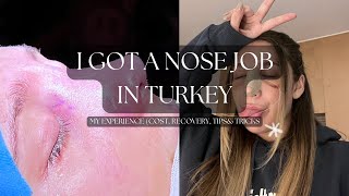 I GOT A NOSE JOB IN TURKEY My Experience [upl. by Gage]