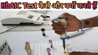 HbA1C test full procedure HbA1C टेस्ट कैसे और क्यों करते हैं LabtechGurukundanSingh [upl. by Ilowell892]