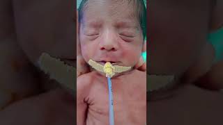 premature twins 1😍😍baby angel cute afterbirth [upl. by Hutner]