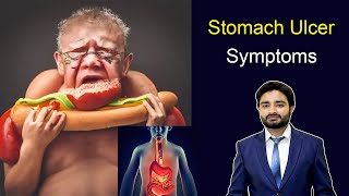 Stomach Ulcer Symptoms  peptic ulcer  Duodenum ulcer  Ulcer symptoms  medical videos  Doctor [upl. by Sirroned]