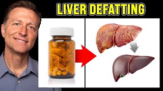 The BEST Vitamin to Cleanse a Fatty Liver  Dr Berg [upl. by Ahsenat]