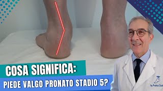 Cosa vuoldire Piede Pronato Valgo al 5° stadio  Dott Andrea Scala [upl. by Karolina]