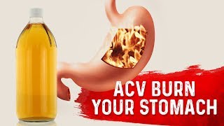 Does Apple Cider Vinegar Burn Your Stomach – DrBerg [upl. by Allys57]