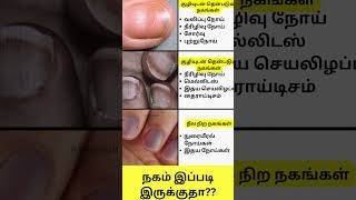 நகம் இப்படி இருக்குதா Nail Disorders in Tamil Shorts intamizh [upl. by Norrehs]