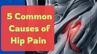 5 Common Reasons for Hip Pain Explained by a Physical Therapist [upl. by Enohs]